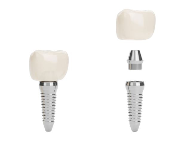 Mesure optique d'implants dentaires